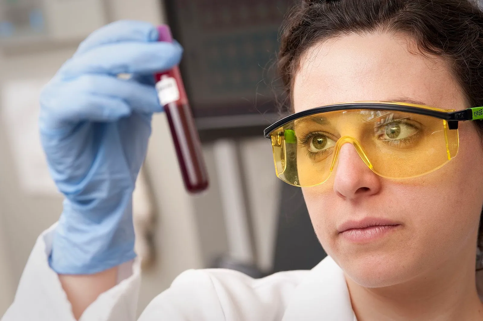 A laboratory blood sample being handled