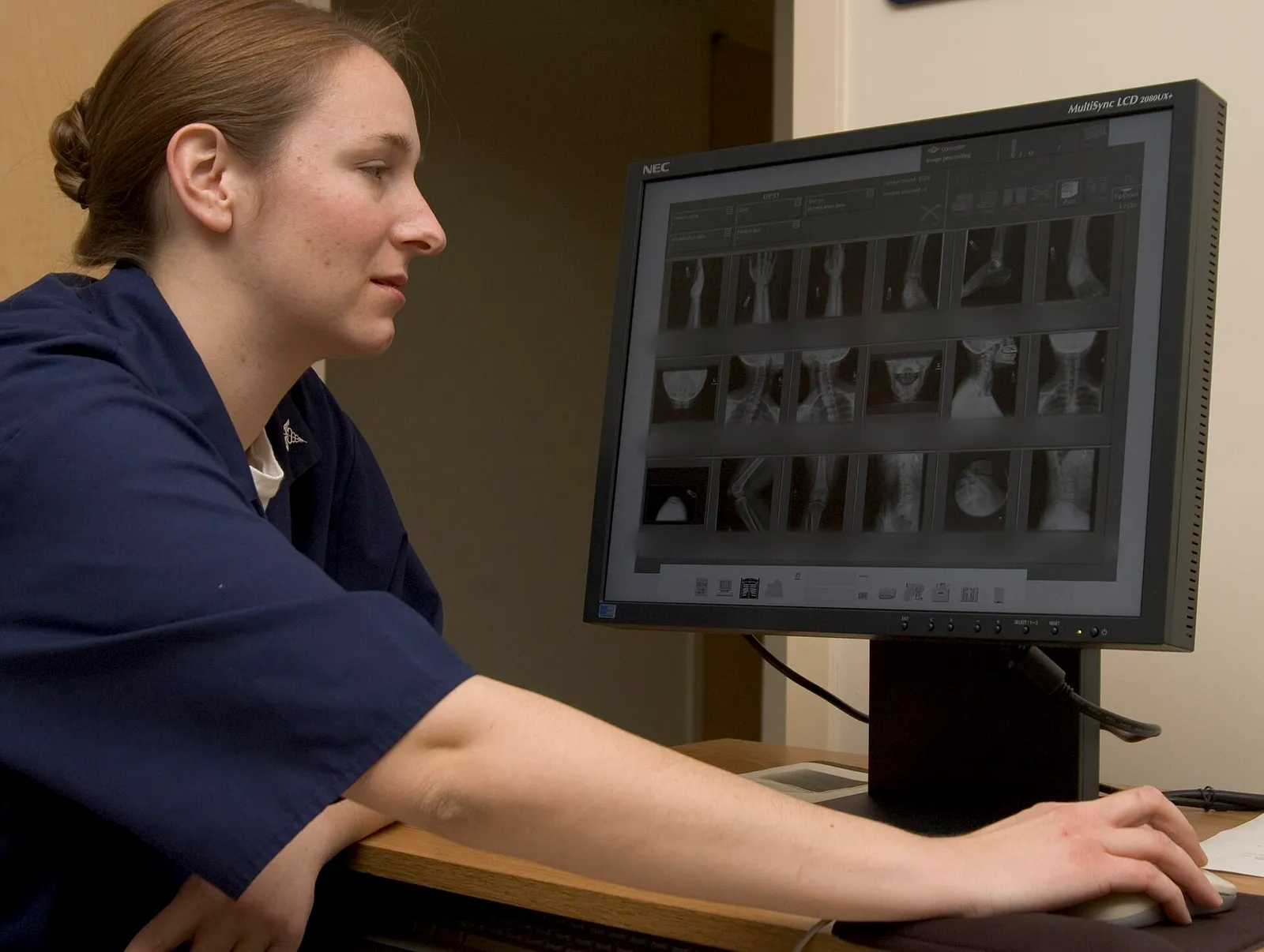 A health worker examining an x-ray in a hospital radiology department